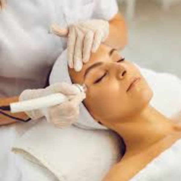 Tratamiento peeling químico
